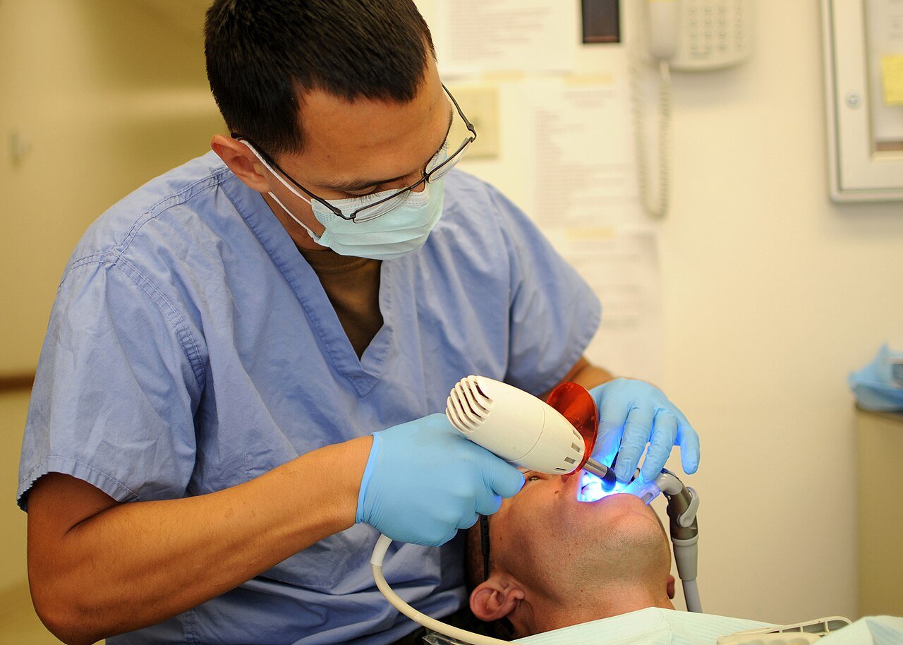 Dentist curing a tooth-colored composite filling with a dental curing light
