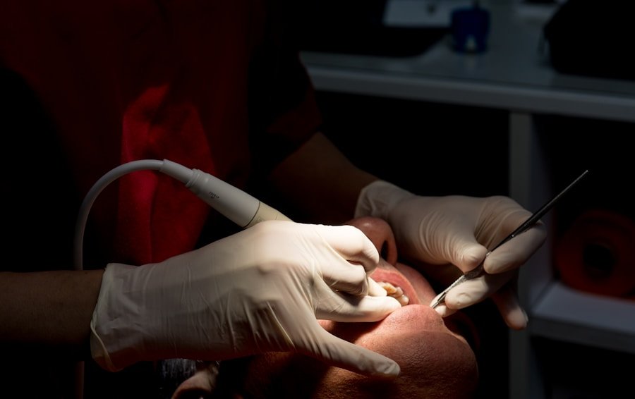 Dentist cleaning patient teeth with professional dental tools